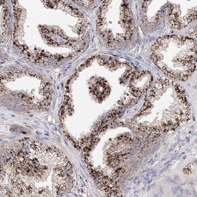 Atlas Antibodies Anti-C3orf38 Antibody