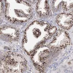 Atlas Antibodies Anti-C3orf38 Antibody