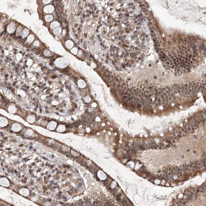 Atlas Antibodies Anti-C3orf38 Antibody