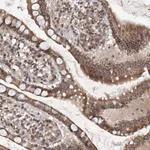 Atlas Antibodies Anti-C3orf38 Antibody