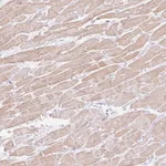 Atlas Antibodies Anti-C3orf49 Antibody