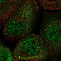 Atlas Antibodies Anti-C3orf52 Antibody