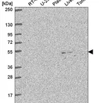 Atlas Antibodies Anti-C3orf67 Antibody