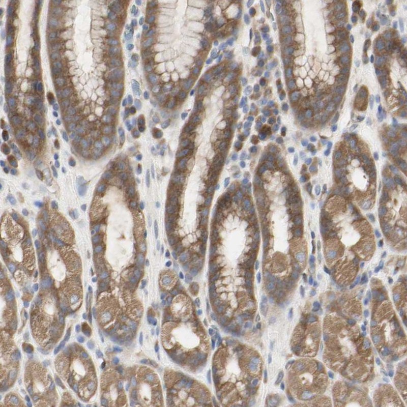 Atlas Antibodies Anti-C3orf52 Antibody