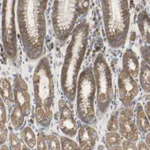 Atlas Antibodies Anti-C3orf52 Antibody