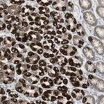 Atlas Antibodies Anti-C3orf52 Antibody