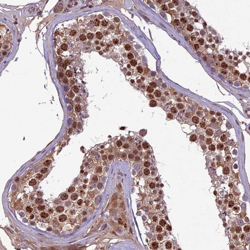 Atlas Antibodies Anti-C3orf70 Antibody