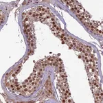 Atlas Antibodies Anti-C3orf70 Antibody