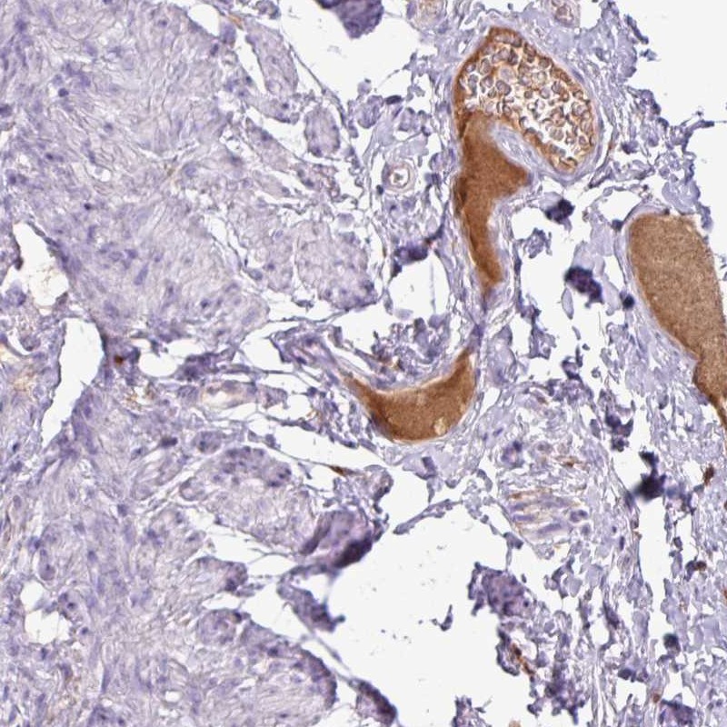 Atlas Antibodies Anti-C4A Antibody