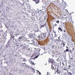 Atlas Antibodies Anti-C4A Antibody