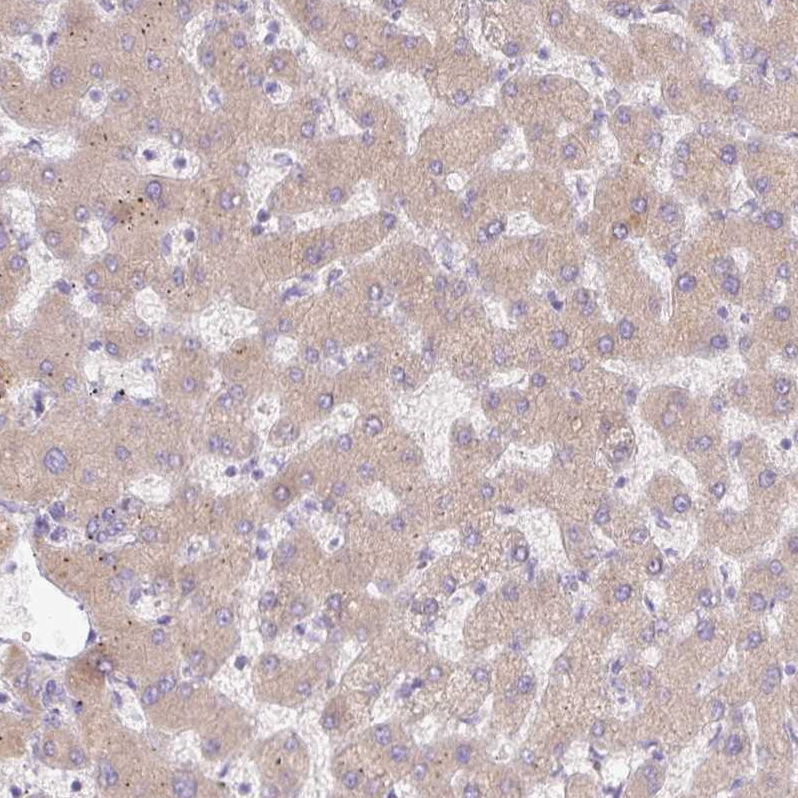 Atlas Antibodies Anti-C4A Antibody