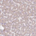 Atlas Antibodies Anti-C4A Antibody