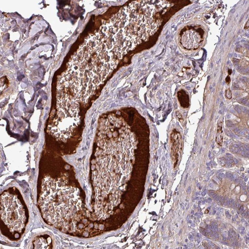 Atlas Antibodies Anti-C4A Antibody