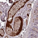 Atlas Antibodies Anti-C4A Antibody