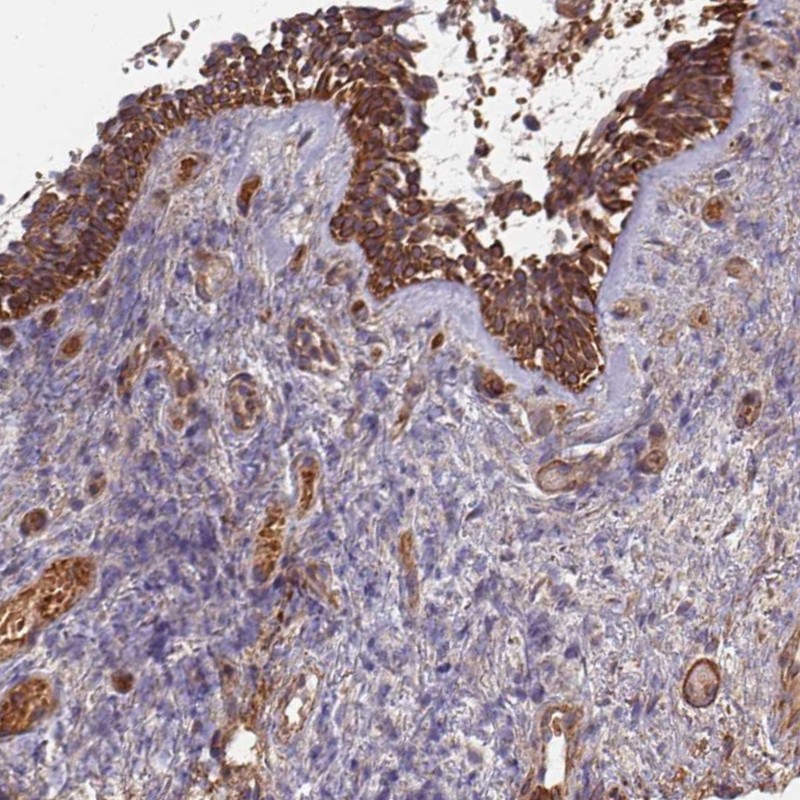 Atlas Antibodies Anti-C4BPB Antibody