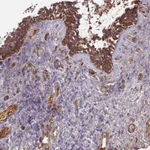 Atlas Antibodies Anti-C4BPB Antibody