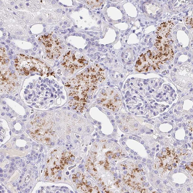Atlas Antibodies Anti-C4orf17 Antibody