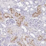Atlas Antibodies Anti-C4orf17 Antibody