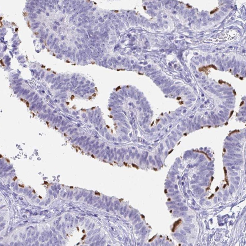 Atlas Antibodies Anti-C4orf17 Antibody