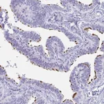 Atlas Antibodies Anti-C4orf17 Antibody