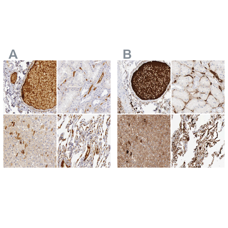 Atlas Antibodies Anti-C4BPA Antibody