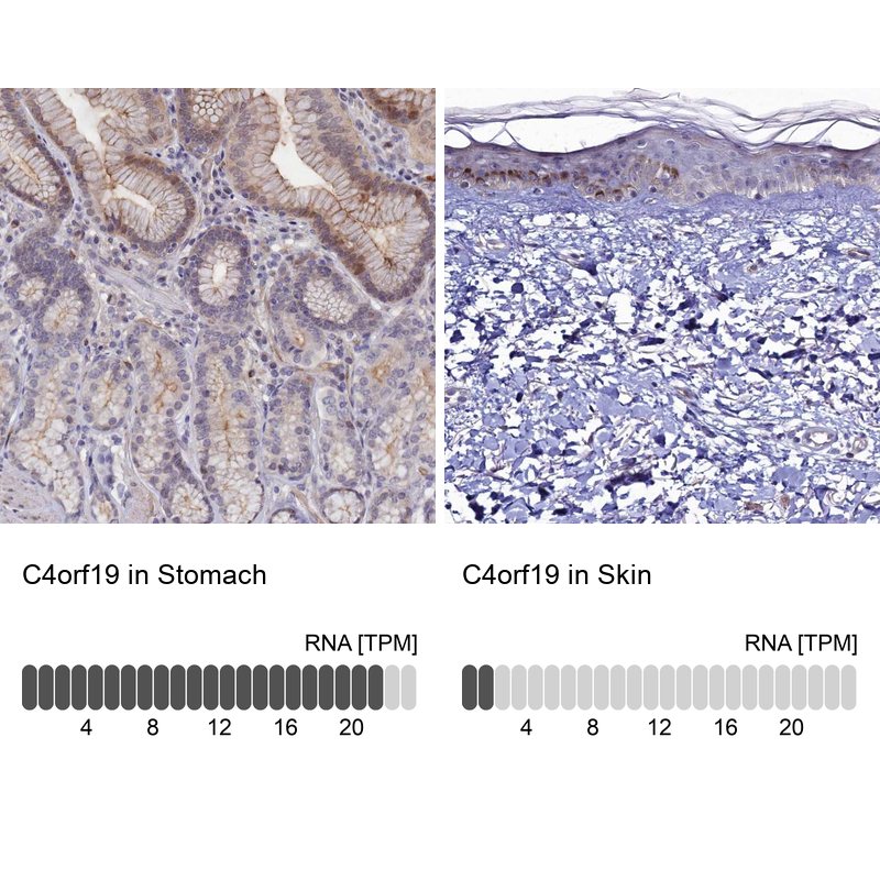 Atlas Antibodies Anti-C4orf19 Antibody