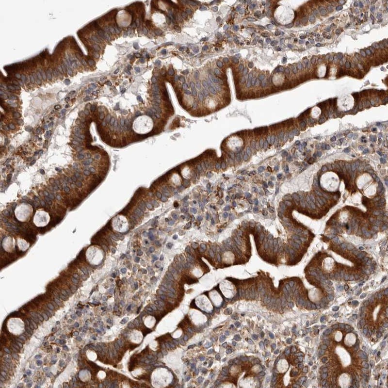 Atlas Antibodies Anti-C4orf3 Antibody
