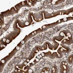 Atlas Antibodies Anti-C4orf3 Antibody