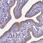 Atlas Antibodies Anti-C4orf22 Antibody