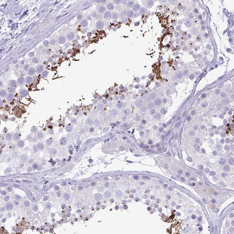 Atlas Antibodies Anti-C4orf33 Antibody