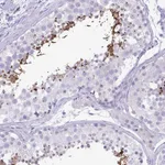 Atlas Antibodies Anti-C4orf33 Antibody