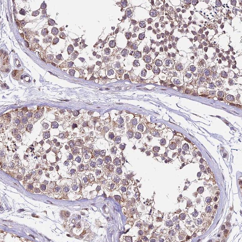 Atlas Antibodies Anti-C4orf47 Antibody