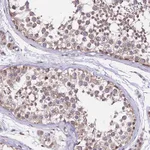 Atlas Antibodies Anti-C4orf47 Antibody