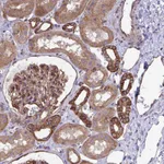 Atlas Antibodies Anti-C4orf36 Antibody