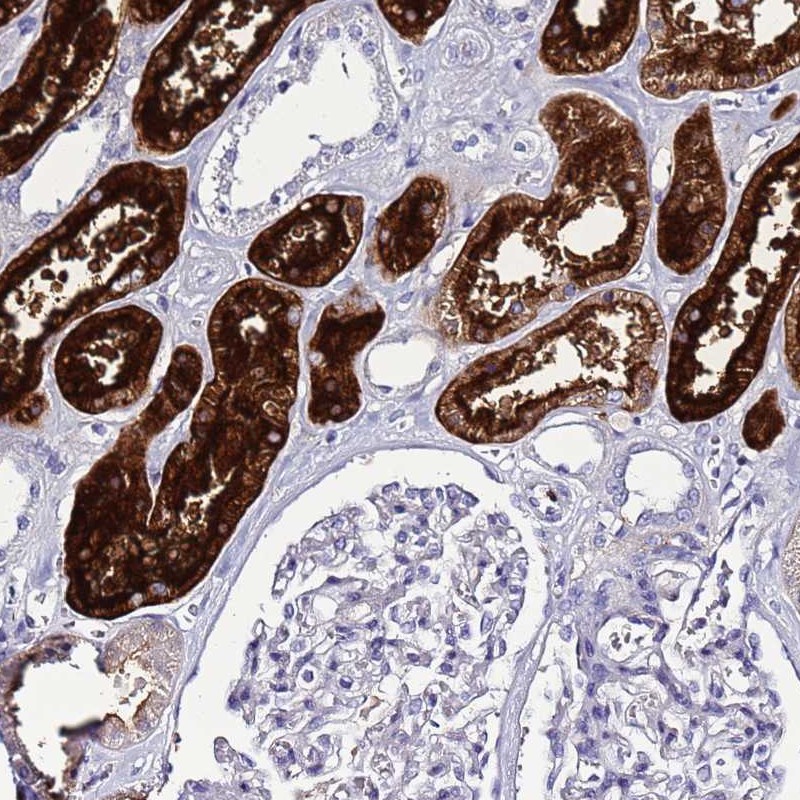 Atlas Antibodies Anti-C4orf46 Antibody