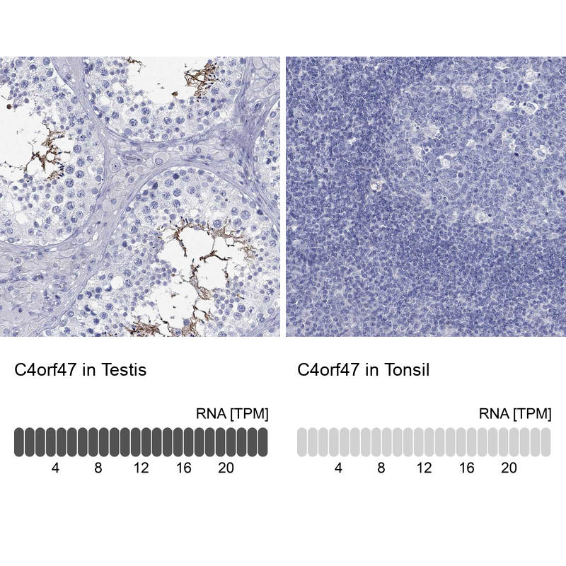 Atlas Antibodies Anti-C4orf47 Antibody
