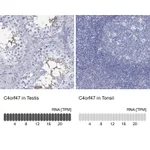 Atlas Antibodies Anti-C4orf47 Antibody