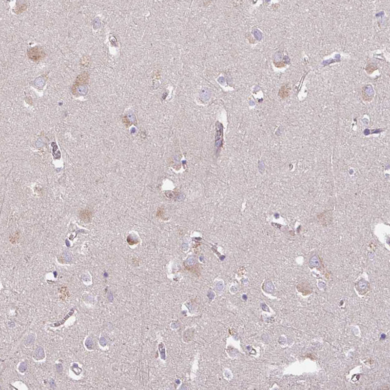 Atlas Antibodies Anti-C4orf48 Antibody