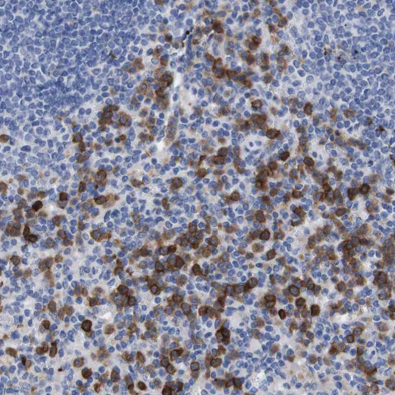 Atlas Antibodies Anti-C5AR1 Antibody