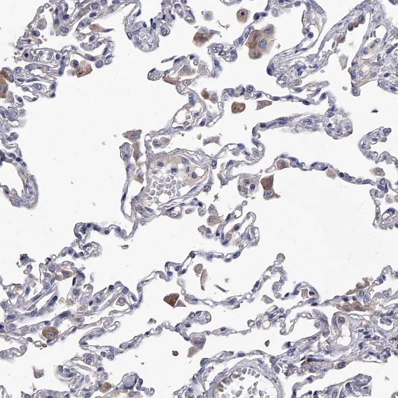 Atlas Antibodies Anti-C5 Antibody