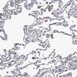 Atlas Antibodies Anti-C5 Antibody