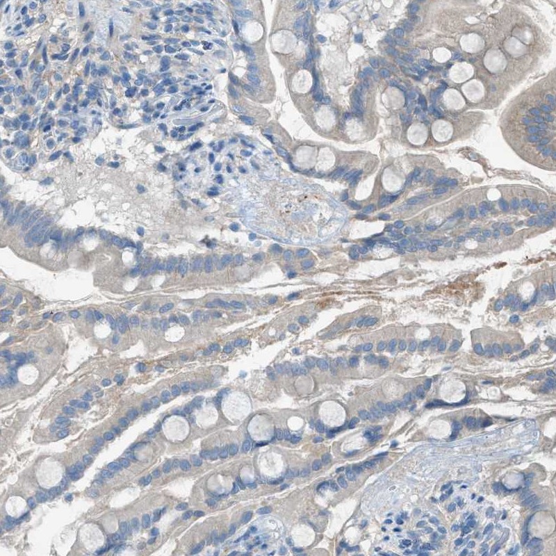 Atlas Antibodies Anti-C5AR2 Antibody