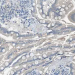 Atlas Antibodies Anti-C5AR2 Antibody