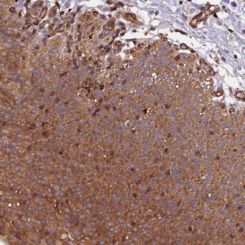Atlas Antibodies Anti-C5orf22 Antibody