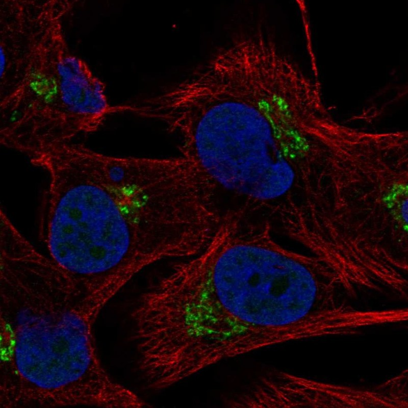 Atlas Antibodies Anti-C5orf15 Antibody