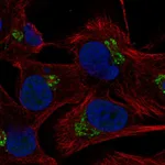 Atlas Antibodies Anti-C5orf15 Antibody