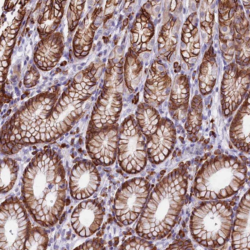 Atlas Antibodies Anti-C5orf15 Antibody