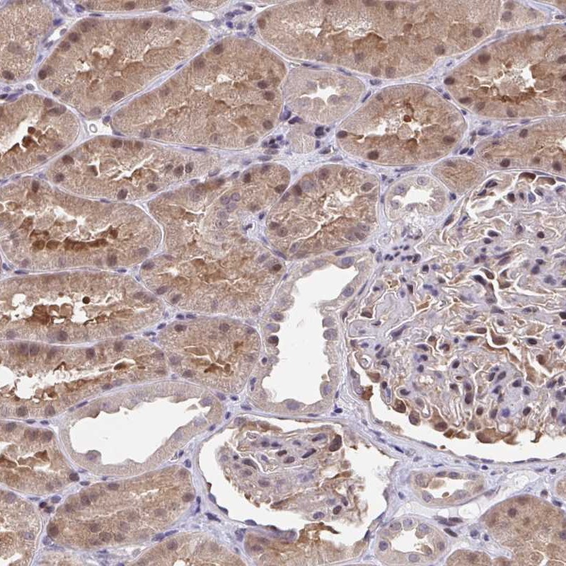 Atlas Antibodies Anti-C5orf24 Antibody