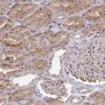 Atlas Antibodies Anti-C5orf24 Antibody