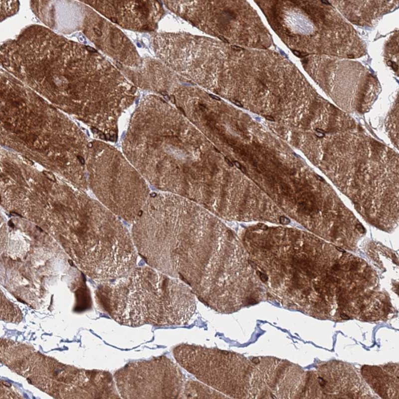 Atlas Antibodies Anti-C5orf34 Antibody
